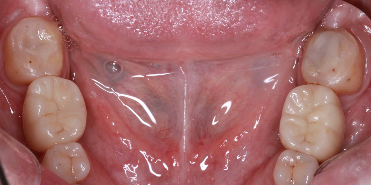 Портфолио - esteldental.ru