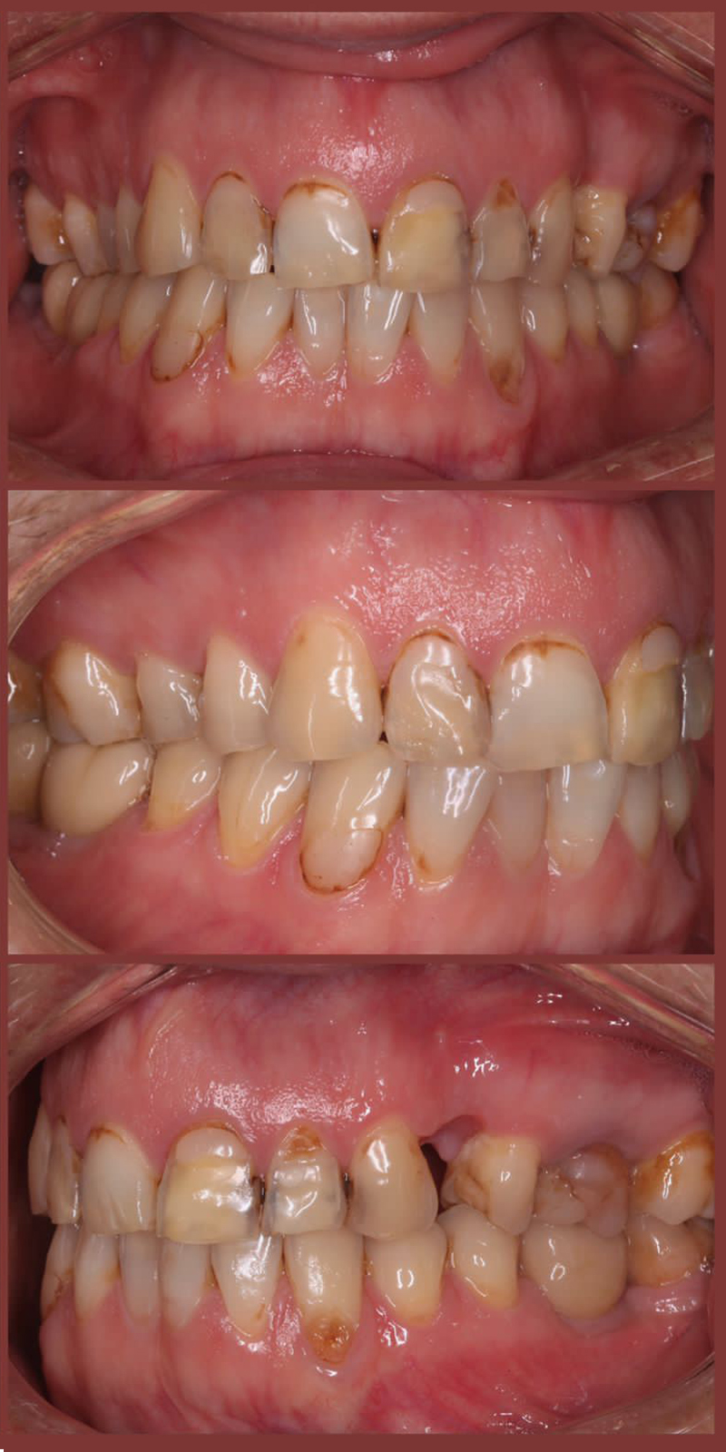 Портфолио - esteldental.ru
