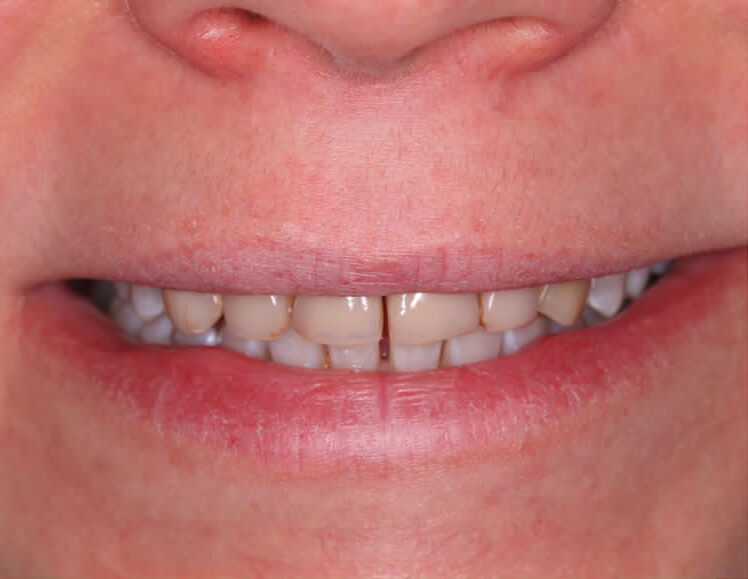 Портфолио - esteldental.ru