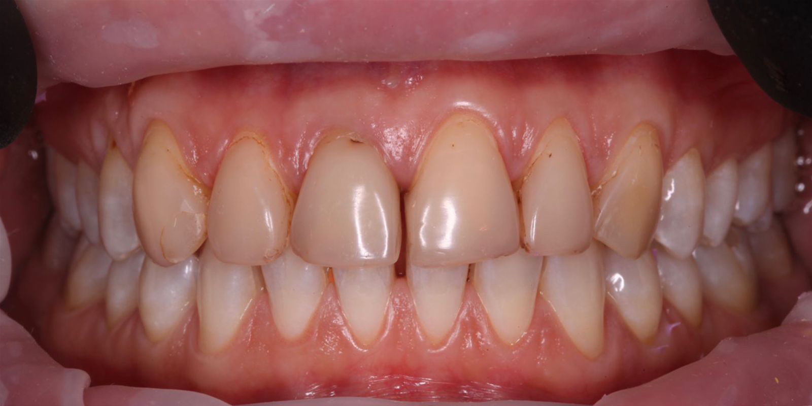 Портфолио - esteldental.ru