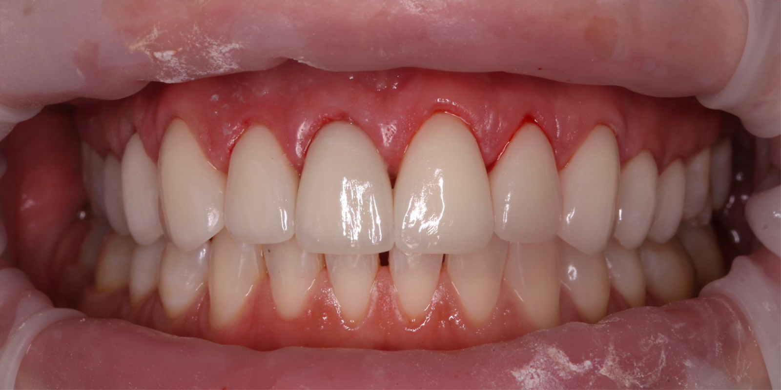 Портфолио - esteldental.ru