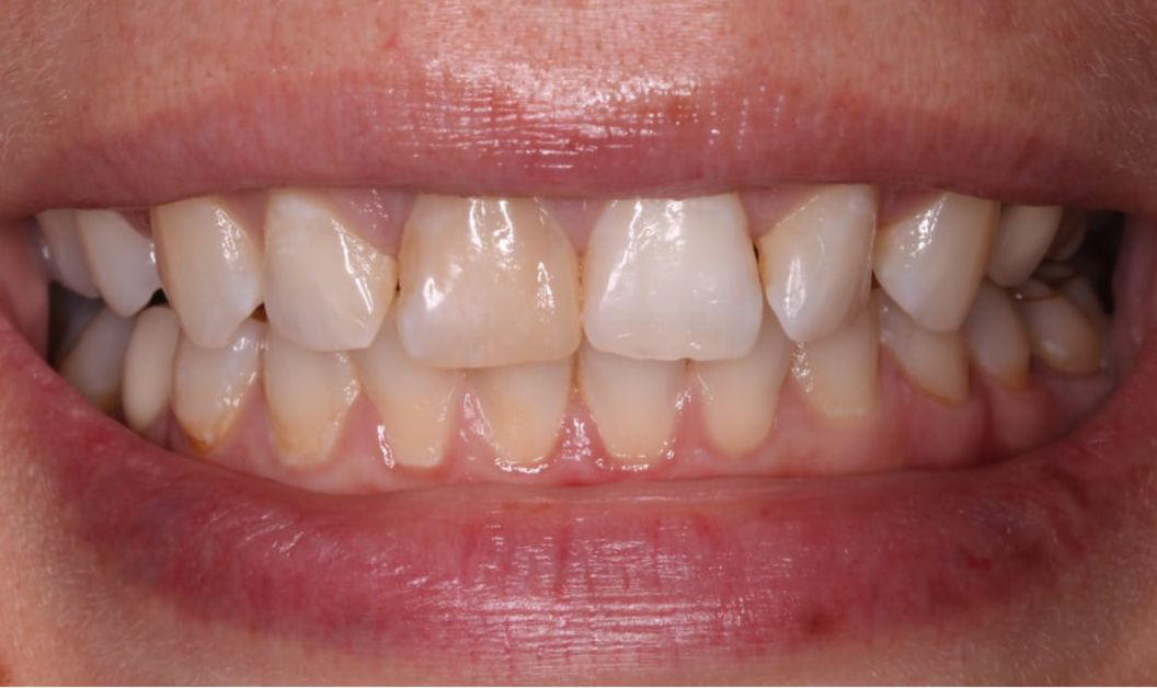 Портфолио - esteldental.ru