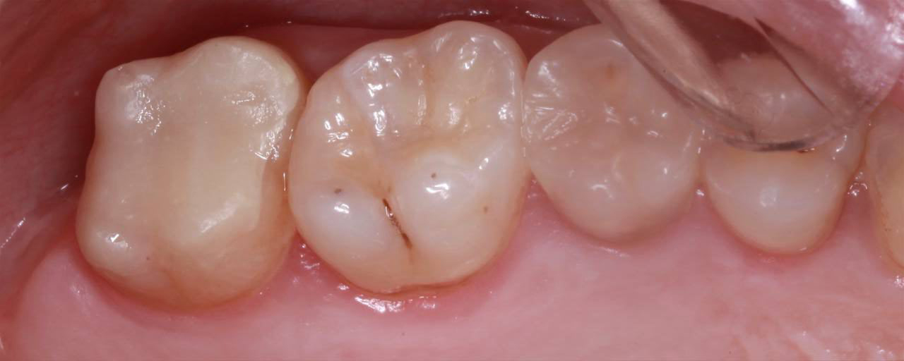 Портфолио - esteldental.ru