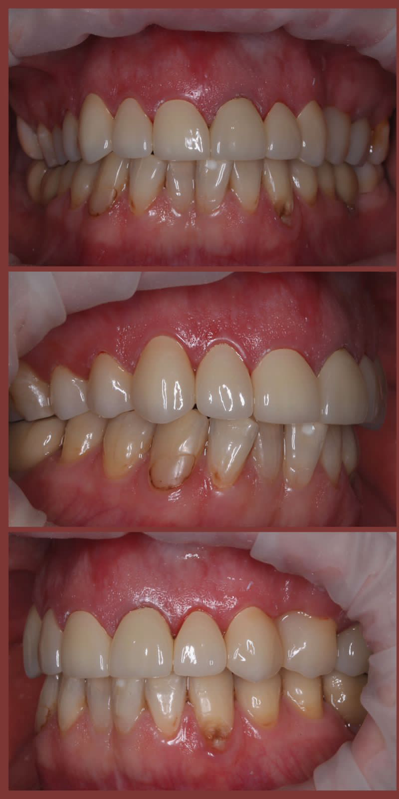 Портфолио - esteldental.ru