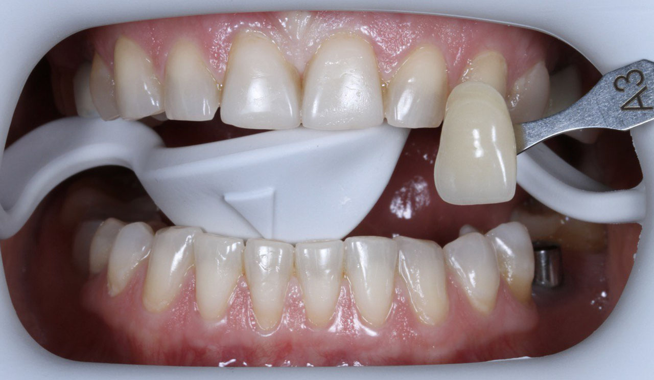 Портфолио - esteldental.ru