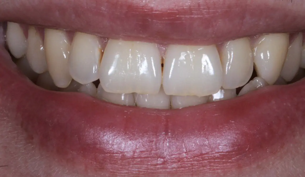 Портфолио - esteldental.ru