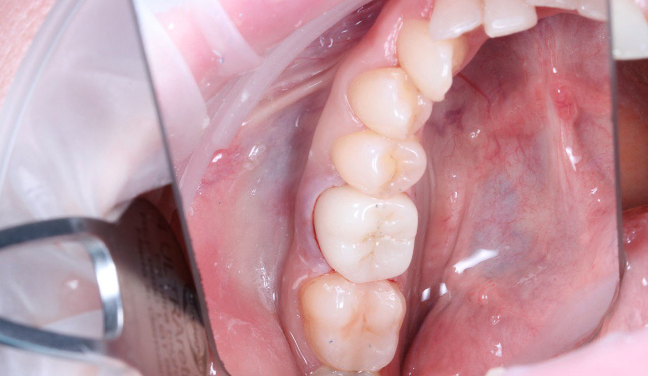 Портфолио - esteldental.ru