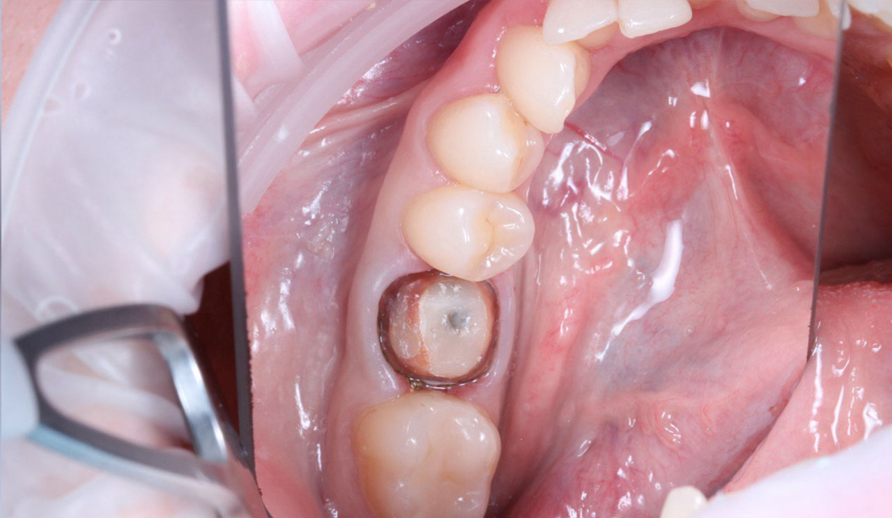 Портфолио - esteldental.ru
