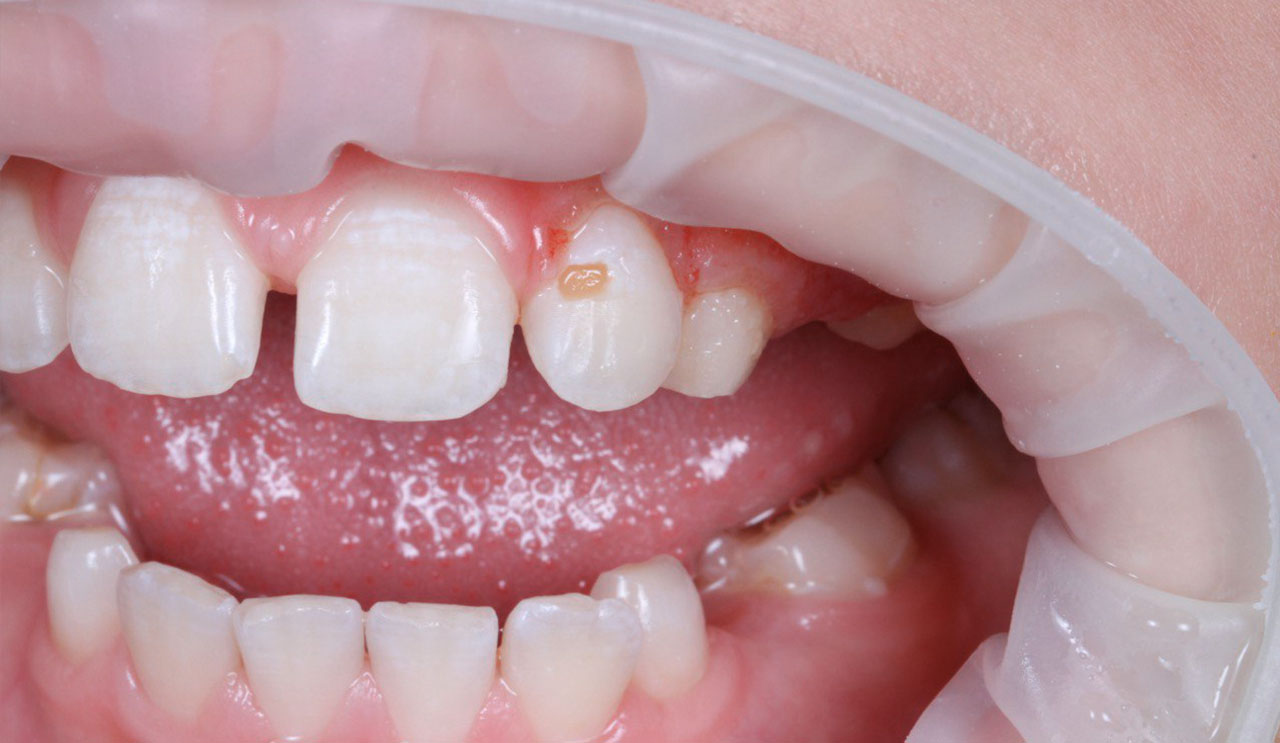 Портфолио - esteldental.ru