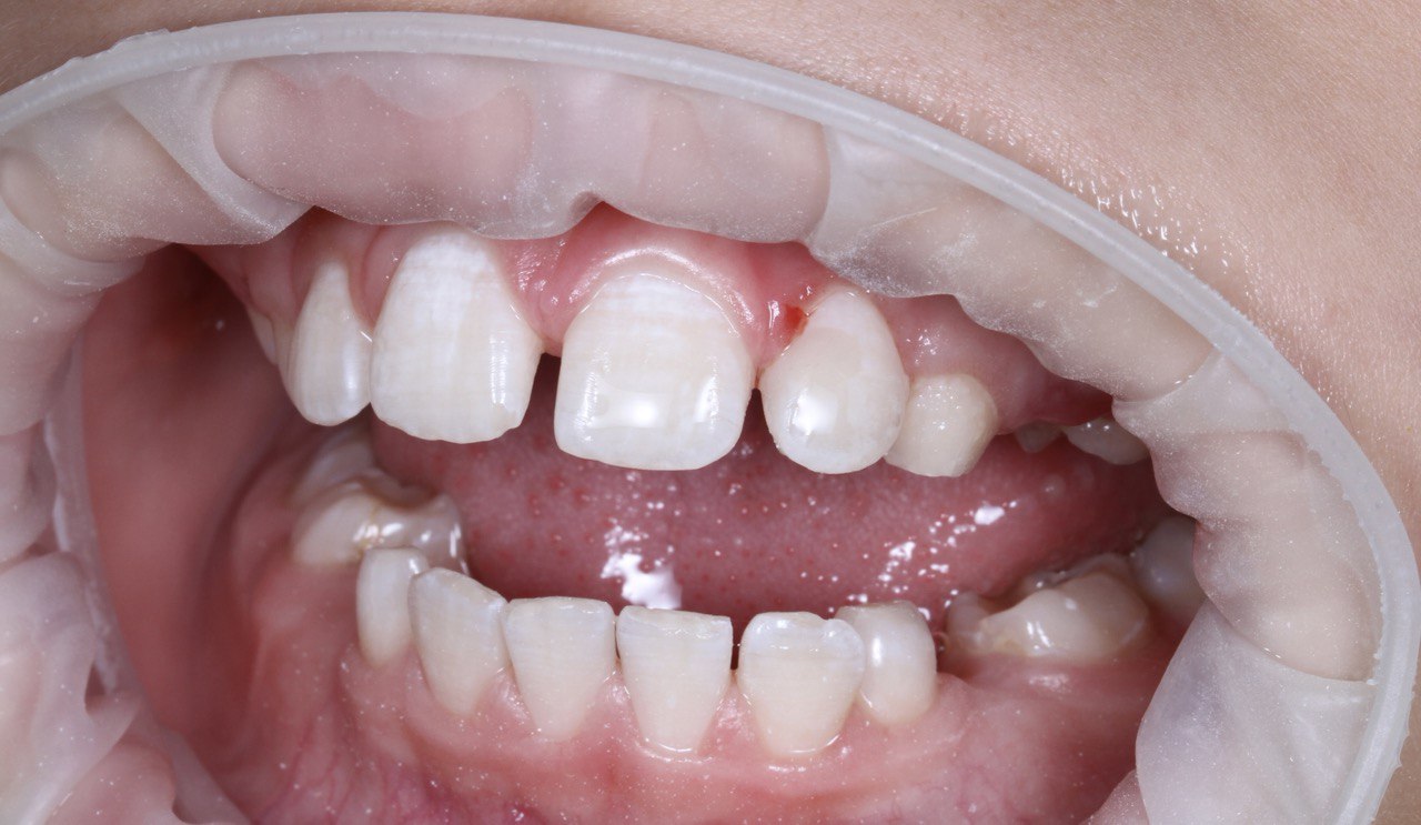 Портфолио - esteldental.ru