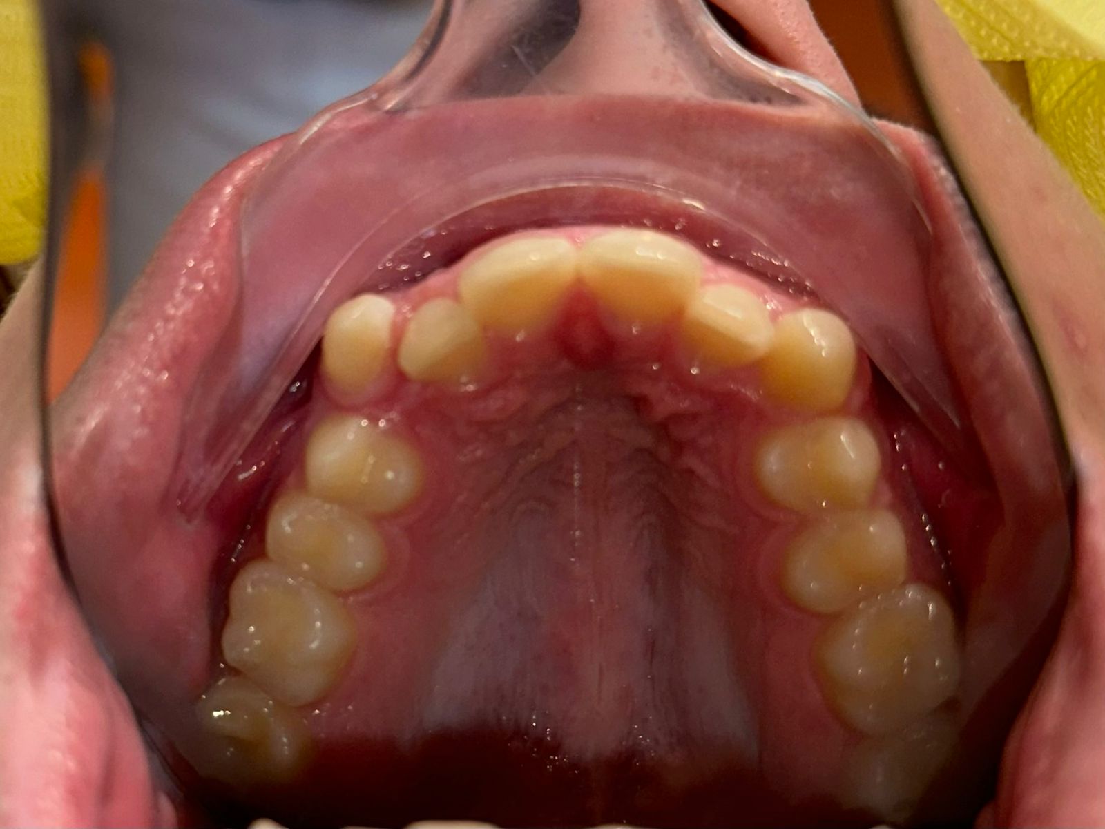 Портфолио - esteldental.ru