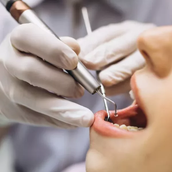 Лечение десен - esteldental.ru