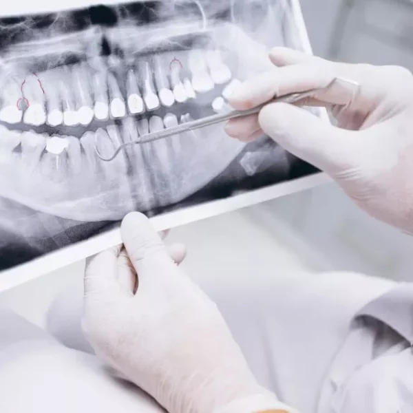 Протезирование зубов - esteldental.ru